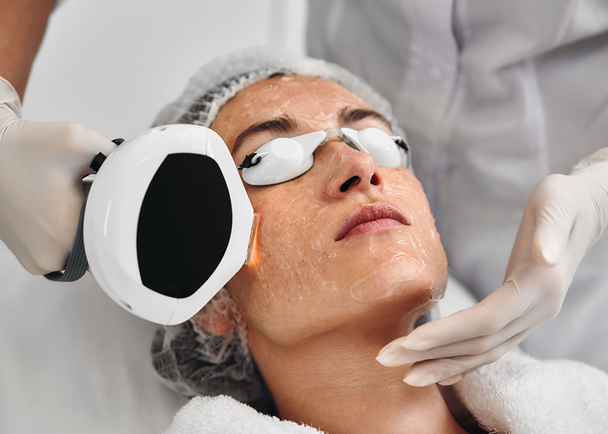 Intense Pulsed Light (IPL)