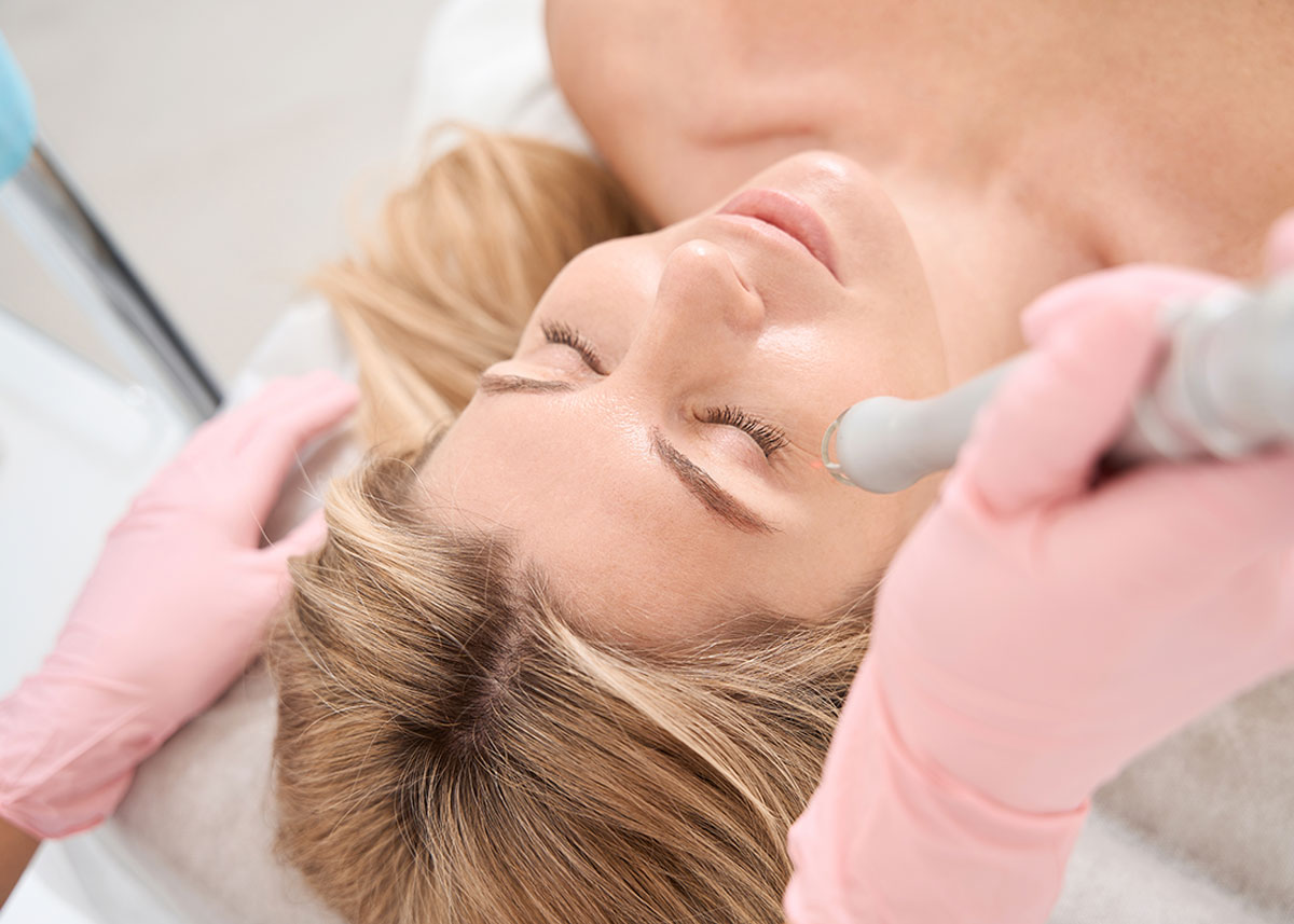 CO2 Laser Skin Resurfacing